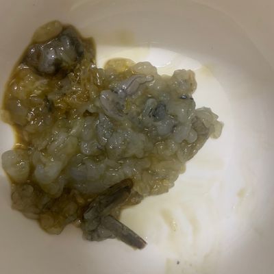 Bước 2