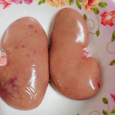 Bước 1