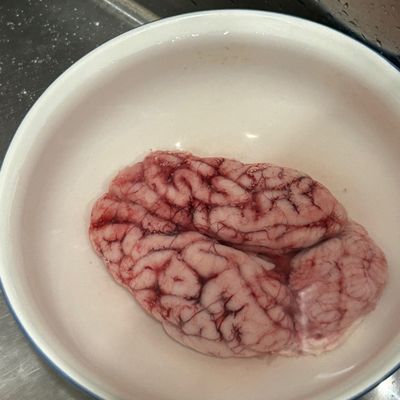 Bước 1