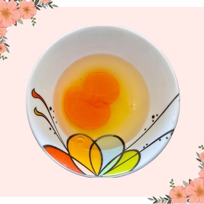 Bước 4