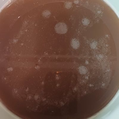 Bước 1